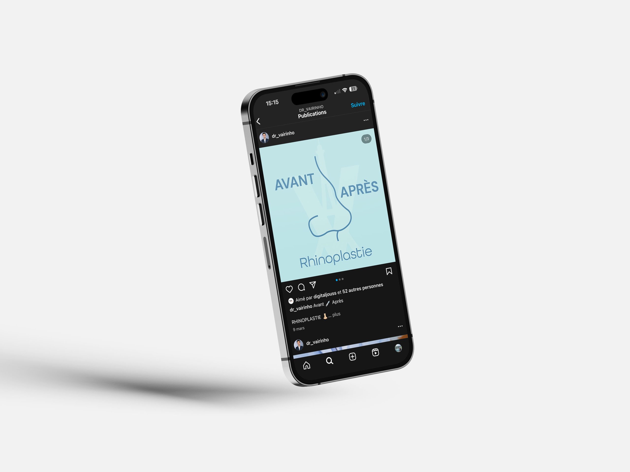 Dr Vairinho 2 Dr Vairinho — publication « avant / après » sur un smartphone