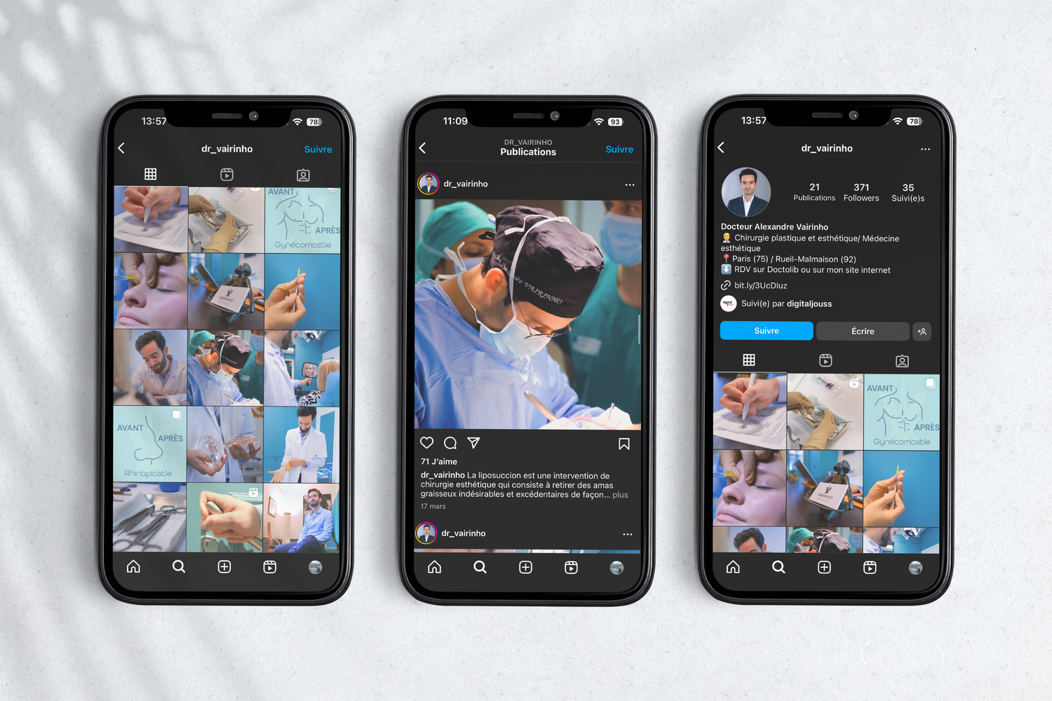 Dr Vairinho — trois smartphones affichant le fil Instagram en mode sombre